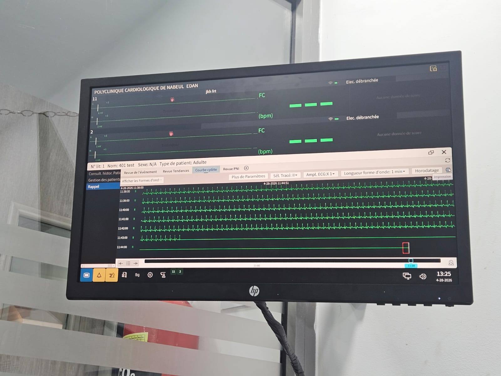 Attivazione della Telemetria Cardiaca al 4° piano