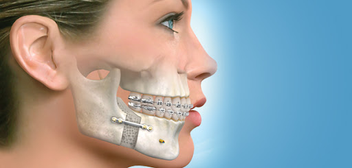 Chirurgia otorinolaringoiatrica e cervico-facciale - 2