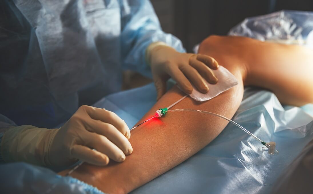 Vascular Surgery - 1
