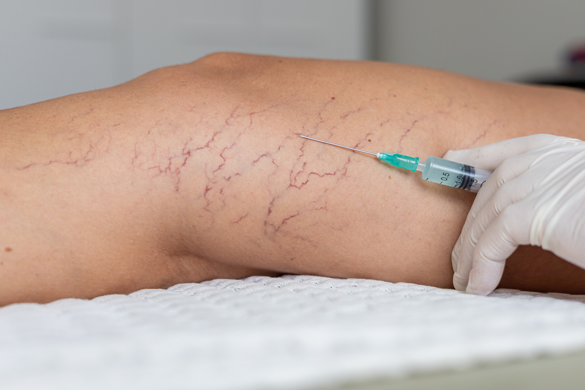 Vascular Surgery - 2